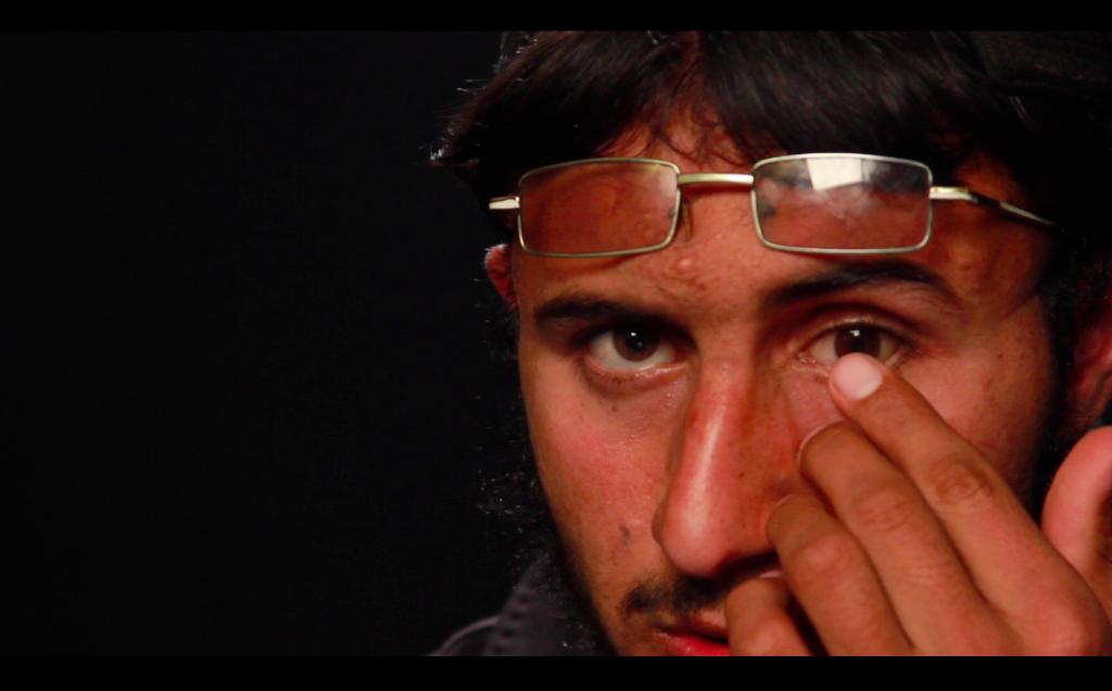 Drone attack survivor Fahim Qureshi, a teenager,  touches his glass eye | Photo: Madiha Tahir